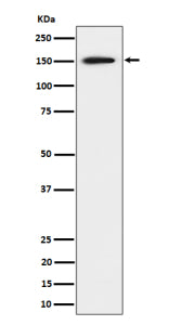 Western blot analysis of SAFB expression in human 293 cell lysate shows a strong band at ~150 kDa, higher than the predicted ~102 kDa, consistent with the phosphorylated and structurally disordered nature of the SAFB protein that causes slower migration on SDS-PAGE.