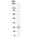 Western blot testing of human prostate lysate with KLK2 antibody at 0.1ug/ml. Predicted molecular weight: ~25kDa.