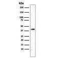 Western blot testing of human kidney tissue lysate using AMACR antibody. Predicted molecular weight ~43 kDa.