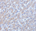 IHC staining of FFPE human liver tissue with Alpha-1-Antichymotrypsin antibody (clone SERPINA3/4185). HIER: boil tissue sections in pH 9 10mM Tris with 1mM EDTA for 20 min and allow to cool before testing.