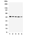 Western blot testing of CBG antibody and Lane 1: HeLa; 2: A431; 3: U87; 4: 22RV1; 5: PANC cell lysate. Expected/observed size ~45KD