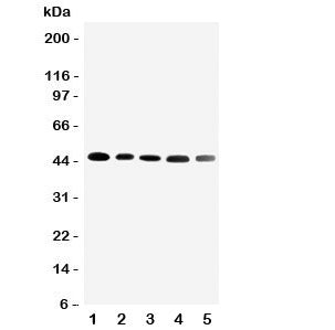 Western blot testing of CBG antibody and Lane 1: HeLa; 2: A431; 3: U87; 4: 22RV1; 5: PANC cell lysate. Expected/observed size ~45KD