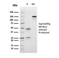 SDS-PAGE analysis of purified, BSA-free recombinant Bromodeoxyuridine antibody (clone rBRD.3) as confirmation of integrity and purity.