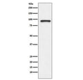 Western blot testing of human Jurkat cell lysate with TOP1 antibody. Expected molecular weight: 91-100 kDa.