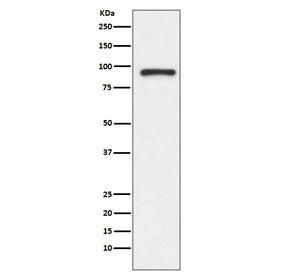 Western blot testing of human Jurkat cell lysate with TOP1 antibody. Expected molecular weight: 91-100 kDa.