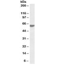 Western blot testing of human tonsil lysate with RAP1 antibody at 0.2ug/ml. Predicted molecular weight ~44kDa but routinely observed at 55~60kDa.