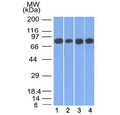 Western blot testing of human 1) HT20, 2) A549, 3) HEK293 and 4) A431 cell lysate with Plakoglobin antibody (clone 11E4). Predicted molecular weight: 80-87 kDa.
