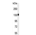 Western blot testing of mouse bladder tissue lysate with TDRD7 antibody. Expected molecular weight: 124-160 kDa.