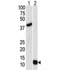 Western blot analysis of SUMO3 antibody and (1) GST-SUMO3 recombinant protein and (2) HL-60 lysate.