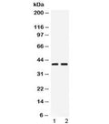 Western blot testing of 1) rat pancreas and 2) human HeLa lysate with PSAT1 antibody at 0.5ug/ml. Predicted/observed molecular weight ~40 kDa.