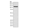 Western blot testing of HUVEC lysate with SELP antibody. Expected molecular weight: 86-140 kDa depending on glycosylation level.