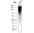 Western blot testing of human colon tissue with CEA antibody (clone CEACAM5/12673). Predicted molecular weight ~77 kDa but may be observed at higher molecular weights due to glycosylation.