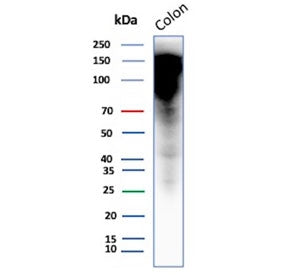 Western blot testing of human colon tissue with CEA antibody (clone CEACAM5/12673). Predicted molecular weight ~77 kDa but may be observed at higher molecular weights due to glycosylation.