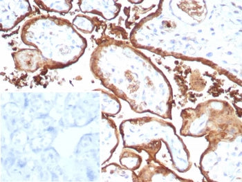 IHC staining of FFPE human placental tissue with recombinant MIG9 antibody (clone S100P/9135R). Inset: PBS used in place of primary Ab (secondary Ab negative control).