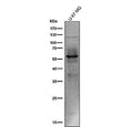 All lanes use the Phospho-Tau (Ser214) antibody at 1:1k dilution for 1 hour at room temperature. The expected molecular weight of phosphorylated Tau (Ser198) is approximately 45-70 kDa, corresponding to the major Tau isoforms, and lower molecular weight bands around ~35 kDa may represent truncated Tau fragments commonly observed in brain tissue.