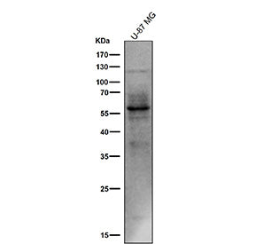 All lanes use the Phospho-Tau (Ser214) antibody at 1:1k dilution for 1 hour at room temperature. The expected molecular weight of phosphorylated Tau (Ser198) is approximately 45-70 kDa, corresponding to the major Tau isoforms, and lower molecular weight bands around ~35 kDa may represent truncated Tau fragments commonly observed in brain tissue.