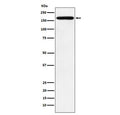 Western blot testing with PODXL antibody. Expected molecular weight of glycosylated form: ~165 kDa.
