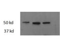 Western blot testing of three different zebrafish adult heart lysate samples with Thrb antibody at 2.5ug/ml. Predicted molecular weight: ~44kDa.