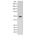 Western blot testing of rat brain lysate with GFAP antibody. Predicted molecular weight ~50 kDa.