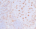 IHC testing of human tonsil (10X) stained with CD68 antibody (C68/684).