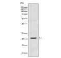 Western blot testing of human K562 cell lysate with MTCO2 antibody. Predicted molecular weight ~25 kDa.