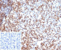 IHC staining of FFPE human tonsil tissue with recombinant CD2 antibody (clone rLFA2/7147). Negative control inset: PBS used instead of primary antibody to control for secondary Ab binding. HIER: boil tissue sections in pH 9 10mM Tris with 1mM EDTA for 20 min and allow to cool before testing.