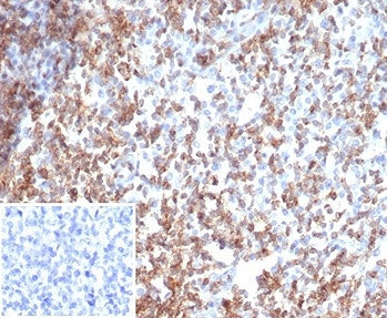 IHC staining of FFPE human tonsil tissue with recombinant CD2 antibody (clone rLFA2/7147). Negative control inset: PBS used instead of primary antibody to control for secondary Ab binding. HIER: boil tissue sections in pH 9 10mM Tris with 1mM EDTA for 20 min and allow to cool before testing.