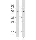 Western blot testing of human 1) 293T/17 and 2) HeLa cell lysate with FZR antibody at 1:2000. Predicted molecular weight: 55 kDa.
