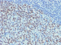 IHC testing of FFPE human tonsil with recombinant Bcl6 antibody (clone ARBC6-2R). Required HIER: boil tissue sections in 10mM citrate buffer, pH 6, for 10-20 min.