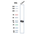 Western blot testing of human colon tissue lysate with CNN1 antibody. Predicted molecular weight ~34 kDa.