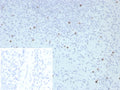 IHC staining of FFPE human spleen tissue with Perforin-1 antibody (clone PRF1/8662R). Inset: PBS used in place of primary Ab (secondary Ab negative control). HIER: boil tissue sections in pH 9 10mM Tris with 1mM EDTA for 20 min and allow to cool before testing.