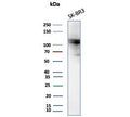 Western blot testing of human SK-BR-3 cell lysate with ADH1L1 antibody (clone ALDH1L1/7701). Predicted molecular weight ~98 kDa.