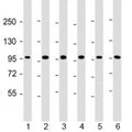 Western blot testing of human 1) HepG2, 2) U-251 MG, 3) A431, 4) HeLa, 5) CCRF-CEM and 6) HL-60 cell lysate with TAF4 antibody at 1:2000. Predicted molecular weight: 110-135 kDa.