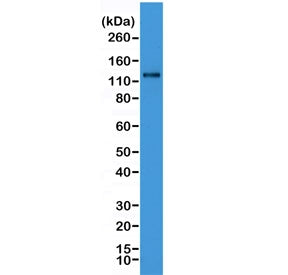 Western blot testing of human HeLa cell lysate with recombinant N-Cadherin antibody. Predicted molecular weight ~100 kDa (unmodified), 125-140 kDa (modified).