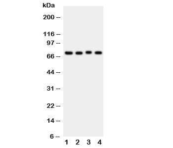 Western blot testing of ABCG2 antibody and Lane 1: rat liver; 2: rat spleen; 3: rat kidney; 4: mouse spleen tissue lysate. Predicted molecular weight ~72kDa.