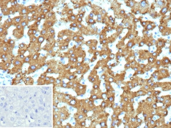 IHC staining of FFPE human hepatocellular carcinoma tissue with 17-beta-HSD 13 antibody (clone HSD17B13/13104). Inset: PBS used in place of primary Ab (secondary Ab negative control). HIER: boil tissue sections in pH 9 10mM Tris with 1mM EDTA for 20 min and allow to cool before testing.