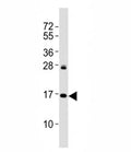 Western blot testing of p16INK4a antibody at 1:2000 dilution + HeLa lysate; Predicted molecular weight: 17 kDa.