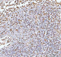 IHC staining of FFPE human spleen tissue with IL22 antibody. HIER: boil tissue sections in pH8 EDTA for 20 min and allow to cool before testing.