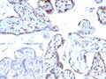 IHC staining of FFPE human placental tissue with p57 antibody (clone KIP2/7639). Strong nuclear staining observed using KIP2/7639 at 2ug/ml in PBS for 30min RT. Inset: PBS used in place of primary Ab (secondary Ab negative control). HIER: boil tissue sections in pH 9 10mM Tris with 1mM EDTA for 20 min and allow to cool before testing.