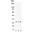 Western blot testing of TIMP4 antibody and Lane 1: HT1080; 2: HeLa; 3: SMMC-7721 cell lysate. Predicted/observed molecular weight: ~25 kDa.