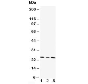 Western blot testing of TIMP4 antibody and Lane 1: HT1080; 2: HeLa; 3: SMMC-7721 cell lysate. Predicted/observed molecular weight: ~25 kDa.