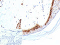 IHC staining of FFPE human skin tissue with Kallikrein 4 antibody (clone KLK4/8942). HIER: boil tissue sections in pH 9 10mM Tris with 1mM EDTA for 20 min and allow to cool before testing.