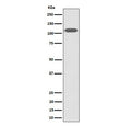 Western blot testing of human HeLa cell lysate with ZHX2 antibody. Predicted molecular weight ~92 kDa, commonly observed at 92-110 kDa.