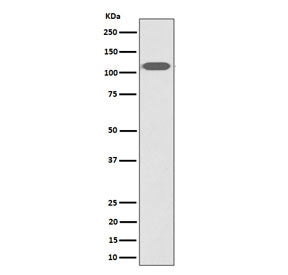 Western blot testing of human HeLa cell lysate with ZHX2 antibody. Predicted molecular weight ~92 kDa, commonly observed at 92-110 kDa.