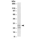 Western blot testing of human cerebellum lysate with FBXO44 antibody at 1.5ug/ml. Predicted molecular weight: ~26kDa.