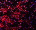 Immunofluorescent staining of FFPE mouse skeletal muscle with Nedd4 antibody (red) and DAPI nuclear stain (blue). HIER: steam section in pH8 EDTA buffer for 20 min.