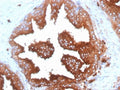 IHC: Formalin-fixed, paraffin-embedded human prostate tissue stained with anti-CD63 antibody (clone SPM524) and DAB chromogen.