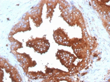 IHC: Formalin-fixed, paraffin-embedded human prostate tissue stained with anti-CD63 antibody (clone SPM524) and DAB chromogen.
