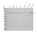 Western blot analysis of PCIF1 using anti-PCIF1 antibody. Electrophoresis was performed on a 10% SDS-PAGE gel at 80V (Stacking gel) / 120V (Resolving gel) for 2 hours. Lane 1: human Caco-2 whole cell lysates, Lane 2: human HepG2 whole cell lysates, Lane 3: human Jurkat whole cell lysates, Lane 4: human MCF-7 whole cell lysates, Lane 5: rat thymus tissue lysates, Lane 6: mouse spleen tissue lysates, Lane 7: mouse thymus tissue lysates.
