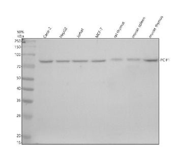 Western blot analysis of PCIF1 using anti-PCIF1 antibody. Electrophoresis was performed on a 10% SDS-PAGE gel at 80V (Stacking gel) / 120V (Resolving gel) for 2 hours. Lane 1: human Caco-2 whole cell lysates, Lane 2: human HepG2 whole cell lysates, Lane 3: human Jurkat whole cell lysates, Lane 4: human MCF-7 whole cell lysates, Lane 5: rat thymus tissue lysates, Lane 6: mouse spleen tissue lysates, Lane 7: mouse thymus tissue lysates.
